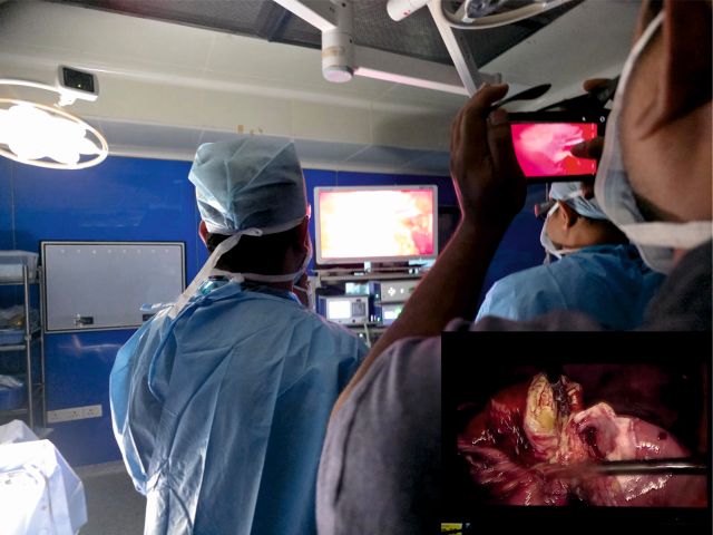 Surgeons at CARE Hospitals, Malakpet Save 72-Year-Old Woman Through High-Risk Laparoscopic Gallbladder Surgery